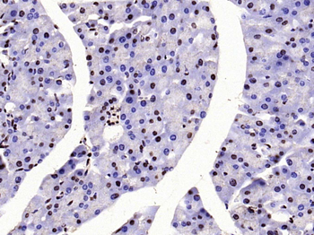 Histone H3 (Acetyl K23) Rabbit Polyclonal Antibody
