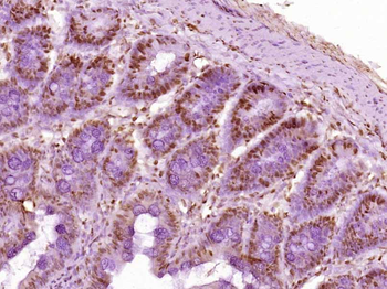 Histone H3 (Acetyl K23) Rabbit Polyclonal Antibody