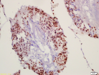 Histone H2B (Acetyl K20) Rabbit Polyclonal Antibody