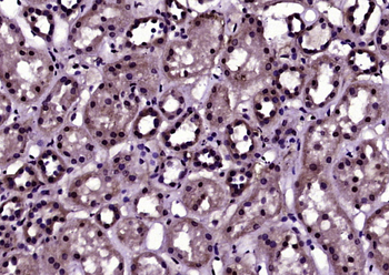 Phospho-Histone H3 (Thr11) Rabbit Polyclonal Antibody