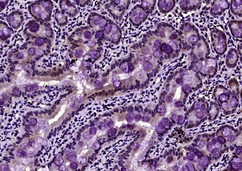 Phospho-Histone H3 (Thr11) Rabbit Polyclonal Antibody