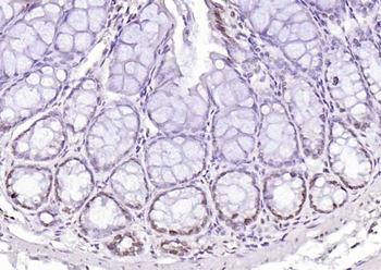 Histone H4 (Acetyl K12) Rabbit Polyclonal Antibody