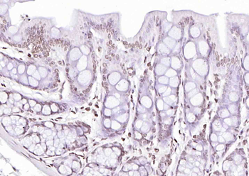 Histone H4 (Acetyl K12) Rabbit Polyclonal Antibody