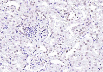 Histone H4 (Acetyl K12) Rabbit Polyclonal Antibody