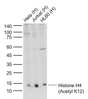 Histone H4 (Acetyl K12) Rabbit Polyclonal Antibody