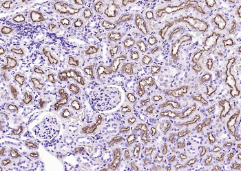 LRP2 Rabbit Polyclonal Antibody