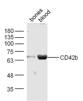 GP1BA Rabbit Polyclonal Antibody
