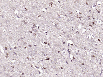 Phospho-HMGCR (Ser872) Rabbit Polyclonal Antibody