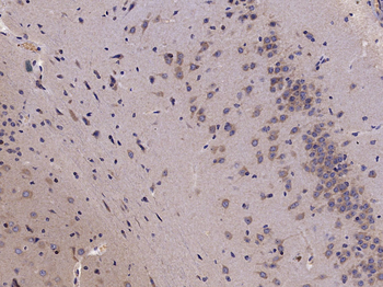 Phospho-HMGCR (Ser872) Rabbit Polyclonal Antibody