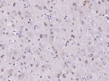 Phospho-HMGCR (Ser872) Rabbit Polyclonal Antibody