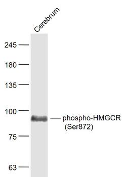Phospho-HMGCR (Ser872) Rabbit Polyclonal Antibody