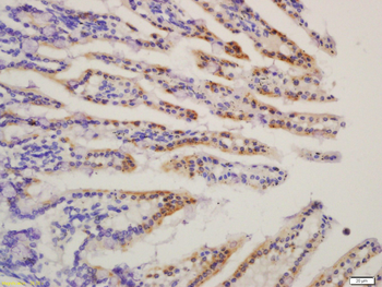 HMGCS2 Rabbit Polyclonal Antibody