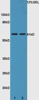 IL22R Rabbit Polyclonal Antibody