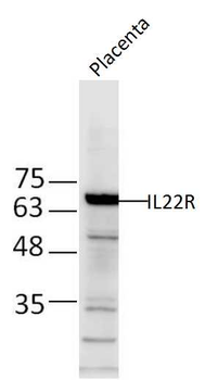 IL22R Rabbit Polyclonal Antibody