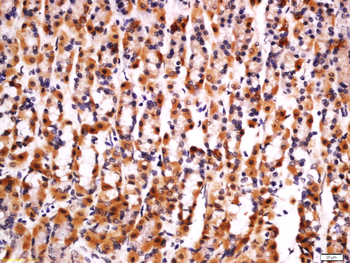 IL33 Rabbit Polyclonal Antibody