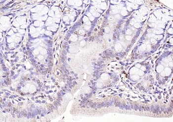 IL33 Rabbit Polyclonal Antibody