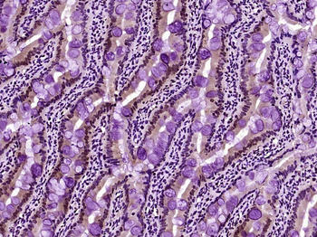 IL33 Rabbit Polyclonal Antibody