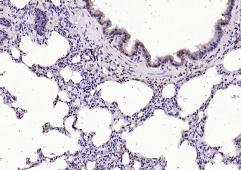 IL33 Rabbit Polyclonal Antibody