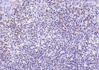 IL33 Rabbit Polyclonal Antibody