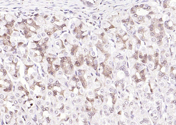 IL33 Rabbit Polyclonal Antibody