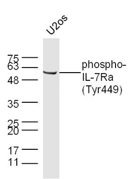 Phospho-IL7R (Tyr449) Rabbit Polyclonal Antibody