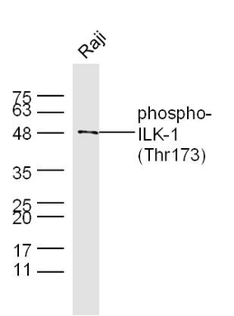 Phospho-ILK-1 (Thr173) Rabbit Polyclonal Antibody