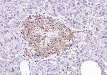 Insulin Rabbit Polyclonal Antibody