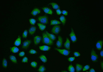 Phospho-IRAK1 (Ser376) Rabbit Polyclonal Antibody