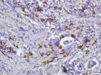 Phospho-IRAK1 (Ser376) Rabbit Polyclonal Antibody