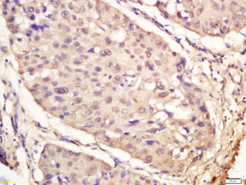 Phospho-IRAK1 (Ser376) Rabbit Polyclonal Antibody