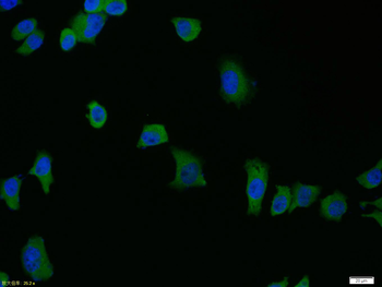 Phospho-IRAK1 (Thr209) Rabbit Polyclonal Antibody