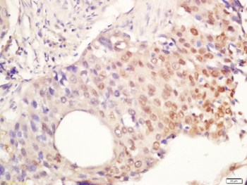 Phospho-IRAK1 (Thr209) Rabbit Polyclonal Antibody