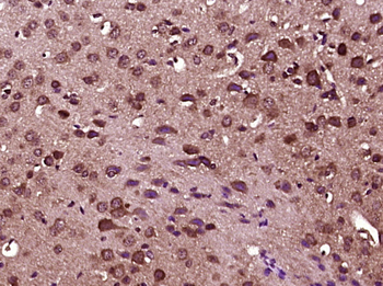 Phospho-IRAK1 (Thr387) Rabbit Polyclonal Antibody