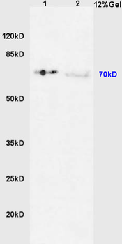 Phospho-IRAK1 (Thr387) Rabbit Polyclonal Antibody