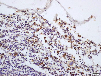 Phospho-IRAK1 (Thr387) Rabbit Polyclonal Antibody