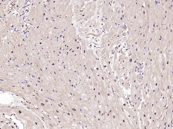 Phospho-IRF3 (Ser396) Rabbit Polyclonal Antibody
