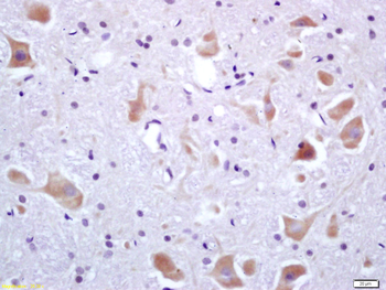 Phospho-IRF3 (Ser396) Rabbit Polyclonal Antibody