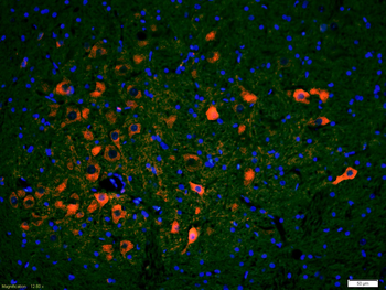 Phospho-IRF3 (Ser396) Rabbit Polyclonal Antibody