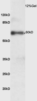 Phospho-IRAK4 (Thr345) Rabbit Polyclonal Antibody