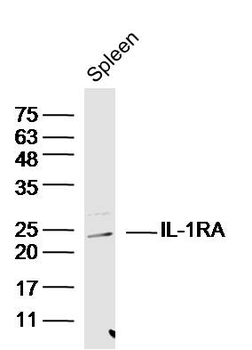 IL-1RA Rabbit Polyclonal Antibody
