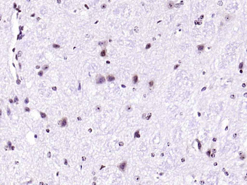 Phospho-IRS1 (Ser636 + Ser639) Rabbit Polyclonal Antibody