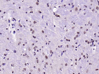 Phospho-IRS1 (Ser636 + Ser639) Rabbit Polyclonal Antibody