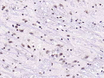 Phospho-IRS1 (Ser636 + Ser639) Rabbit Polyclonal Antibody