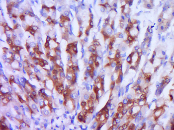 Phospho-IRS1 (Ser789) Rabbit Polyclonal Antibody