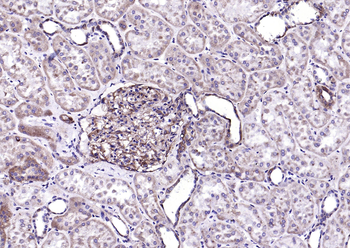 ITGAV Rabbit Polyclonal Antibody