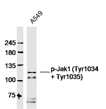 Phospho-Jak1 (Tyr1034 + Tyr1035) Rabbit Polyclonal Antibody