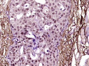 Phospho-JAK2 (Tyr221) Rabbit Polyclonal Antibody