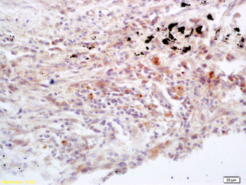 Jak3 Rabbit Polyclonal Antibody
