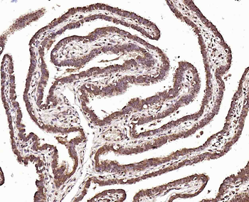 JMJD1B Rabbit Polyclonal Antibody