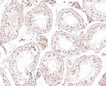 JMJD1B Rabbit Polyclonal Antibody